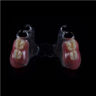 Prothèse partielle acrylique amovible