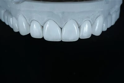 Placage en céramique mince